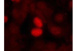 Immunofluorescence staining of methanol-fixed MCF7 cells using FKHR(Phospho-Ser256) Antibody. (FOXO1 anticorps  (pSer256))