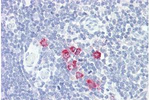 Anti-GlcNAc6ST2 / CHST4 antibody IHC staining of human thymus. (CHST4 anticorps  (AA 234-283))
