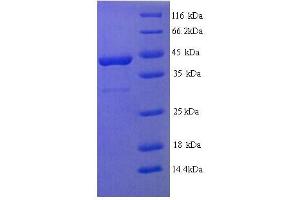 SDS-PAGE (SDS) image for Fibroblast Growth Factor Receptor 3 (FGFR3) (AA 23-375), (Extracellular) protein (His tag) (ABIN5713454)