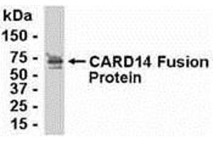 Western Blotting (WB) image for anti-Caspase Recruitment Domain Family, Member 14 (CARD14) (AA 221-330) antibody (ABIN2468032) (CARD14 anticorps  (AA 221-330))