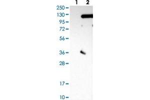 Western Blot (Cell lysate) analysis with SRPK2 polyclonal antibody  Lane 1: Negative control (vector only transfected HEK293T lysate)  Lane 2: Over-expression lysate (Co-expressed with a C-terminal myc-DDK tag (~3. (SRPK2 anticorps)