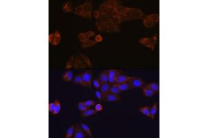 Immunofluorescence analysis of HeLa cells using CES1 Rabbit mAb (ABIN7266077) at dilution of 1:100 (40x lens). (CES1 anticorps)