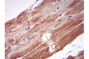 Immunohistochemical analysis of paraffin-embedded striated muscle tissues using NPC1 mouse mAb with DAB staining.