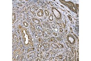 IHC analysis of DLAT using anti-DLAT antibody (ABIN7602307). (DLAT anticorps  (AA 69-642))
