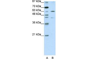 WB Suggested Anti-ZNF496 Antibody Titration:  1. (ZNF496 anticorps  (N-Term))