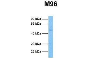 Host:  Rabbit  Target Name:  M96  Sample Tissue:  Human HCT116  Antibody Dilution:  1. (MTF2 anticorps  (Middle Region))