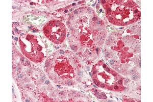 Anti-SLC14A1 / JK antibody IHC staining of human kidney.