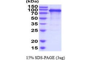 SDS-PAGE (SDS) image for CUB Domain Containing Protein 1 (CDCP1) (AA 30-667) protein (His tag) (ABIN5777935) (CDCP1 Protein (AA 30-667) (His tag))