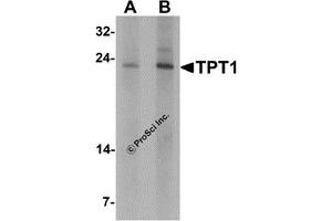 Western Blotting (WB) image for anti-Tumor Protein, Translationally-Controlled 1 (TPT1) antibody (ABIN1077430) (TPT1 anticorps)