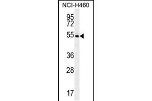Western blot analysis in NCI-H460 cell line lysates (35ug/lane). (GS (AA 380-408), (C-Term) anticorps)