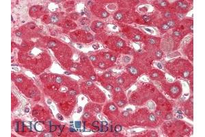 IHC-P analysis of Human Liver Tissue, with HE staining. (Ceruloplasmin anticorps  (AA 789-1065))