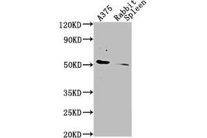 Western Blot Positive WB detected in: A375 whole cell lysate, Rabbit spleen tissue All lanes CD63 antibody at 1:1000 Secondary Goat polyclonal to mouse IgG at 1/50000 dilution Predicted band size: 30-120 KD KDa Observed band size: 30-120 KD KDa Exposure time:1 min