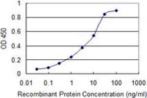 Detection limit for recombinant GST tagged SRD5A2 is 0.