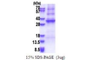 SDS-PAGE (SDS) image for Adenosine Deaminase-Like Protein (ADAL) (AA 1-267) protein (His tag) (ABIN5853646)