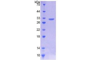SDS-PAGE analysis of Human Kruppel Like Factor 5, Intestinal (KLF5) Protein. (KLF5 Protéine)