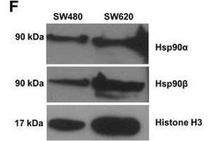 Investigating the status of the canonical TGF-β pathway and levels of Hsp90 in the genetically paired SW480 primary and SW620 secondary tumour-derived colon cancer cell lines.