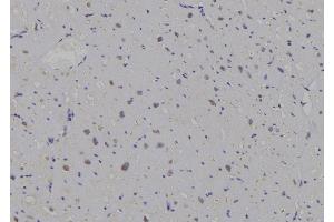 ABIN6269296 at 1/100 staining Human heart tissue by IHC-P.