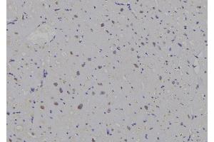 ABIN6269296 at 1/100 staining Human heart tissue by IHC-P. (14-3-3 zeta anticorps  (C-Term))