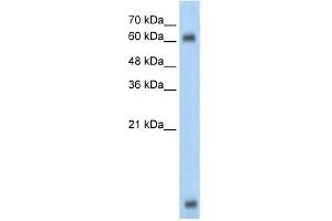 WB Suggested Anti-MBD1 Antibody Titration:  0. (MBD1 anticorps  (C-Term))