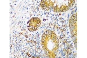 Immunohistochemistry of paraffin-embedded Human appendix using ERLIN1 Polyclonal Antibody at dilution of 1:100 (40x lens). (ERLIN1 anticorps)