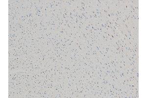 ABIN6267443 at 1/100 staining rat heart tissue sections by IHC-P.