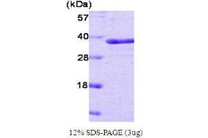 Figure annotation denotes ug of protein loaded and % gel used.