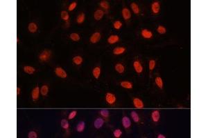 Immunofluorescence analysis of U-2 OS cells using Bcl-2 Polyclonal Antibody at dilution of 1:100 (40x lens). (Bcl-2 anticorps)