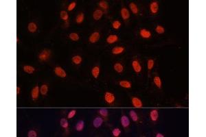 Immunofluorescence analysis of U-2 OS cells using Bcl-2 Polyclonal Antibody at dilution of 1:100 (40x lens).