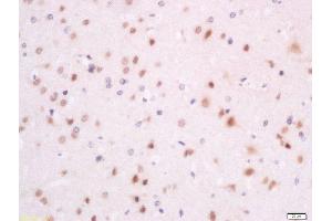 Formalin-fixed and paraffin embedded rat brain labeled with Anti-SFRS7/9G8 Polyclonal Antibody, Unconjugated  at 1:200 followed by conjugation to the secondary antibody and DAB staining (SFRS7 anticorps  (AA 2-70))
