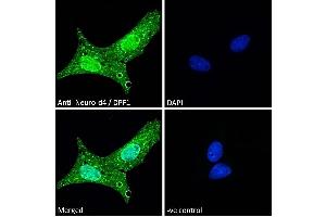 ABIN184922 Immunofluorescence analysis of paraformaldehyde fixed U2OS cells, permeabilized with 0.