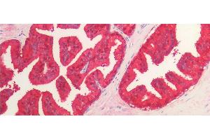 Detection of IDH1 in Human Prostate Tissue using Monoclonal Antibody to Isocitrate Dehydrogenase 1, Soluble (IDH1) (IDH1 anticorps  (AA 74-333))