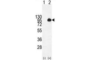Western blot analysis of MUC20 antibody and 293 cell lysate (2 ug/lane) either nontransfected (Lane 1) or transiently transfected with the MUC20 gene (2). (MUC20 anticorps  (AA 61-90))