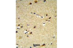 Immunohistochemistry (IHC) image for anti-Cytochrome P450, Family 26, Subfamily A, Polypeptide 1 (CYP26A1) antibody (ABIN2995234)