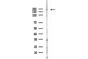 Western blot analysis of lysates from Rat brain, using DOCK4 Antibody at 1/1000 dilution.