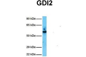 Host:  Rabbit  Target Name:  GDI2  Sample Tissue:  Human Fetal Lung  Antibody Dilution:  1. (GDI2 anticorps  (C-Term))