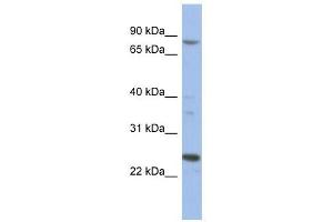 MARK3 antibody used at 1 ug/ml to detect target protein. (MARK3 anticorps  (Middle Region))