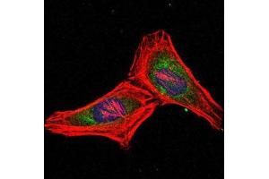 Immunofluorescence analysis of Hela cells using PSMB8 mouse mAb (green).