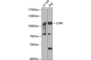 Western blot analysis of extracts of various cell lines, using LGR6 antibody (ABIN6130405, ABIN6143182, ABIN6143184 and ABIN6223245) at 1:1000 dilution. (LGR6 anticorps  (AA 350-510))