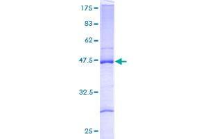 Image no. 1 for Ribosomal Protein L27a (RPL27A) (AA 1-148) protein (GST tag) (ABIN1318589)