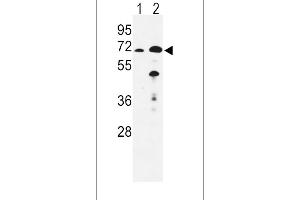 Western blot analysis of EHHADH Antibody in mouse liver(lane 1), kidney(lane 2) tissue lysates (35ug/lane) (EHHADH anticorps  (C-Term))
