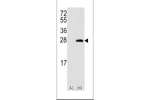 Western blot analysis of OPRS1 (arrow) using rabbit polyclonal OPRS1 Antibody (Center) (ABIN389222 and ABIN2839375). (SIGMAR1 anticorps  (AA 118-147))