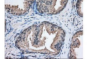 Immunohistochemistry (IHC) image for anti-Nucleoredoxin-Like 2 (NXNL2) antibody (ABIN1499887) (NXNL2 anticorps)