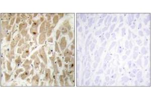 Immunohistochemistry analysis of paraffin-embedded human heart tissue, using FOXD3 Antibody.