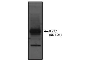 Image no. 1 for anti-Potassium Voltage-Gated Channel, Shaker-Related Subfamily, Member 1 (KCNA1) antibody (ABIN265021) (KCNA1 anticorps)