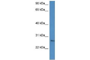 WB Suggested Anti-CMA1 Antibody Titration: 0. (CMA1 anticorps  (C-Term))