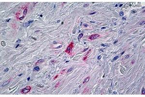 Human Prostate, Stroma: Formalin-Fixed, Paraffin-Embedded (FFPE)