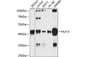 Western blot analysis of extracts of various cell lines, using HLA-E antibody (ABIN6133750, ABIN6141843, ABIN6141845 and ABIN6224489) at 1:1000 dilution. (HLA-E anticorps  (AA 1-100))