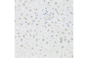 Immunohistochemistry of paraffin-embedded rat liver using AKT1 antibody (ABIN5997218) at dilution of 1/100 (40x lens). (AKT1 anticorps)