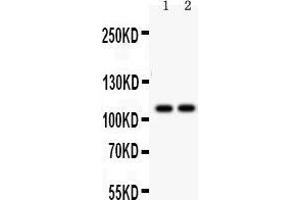 Anti- ATP2A1 antibody, Western blotting All lanes: Anti ATP2A1  at 0.