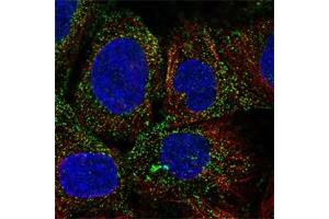 Immunofluorescent staining of A-431 cell line with antibody shows positivity in vesicles (green). (PDGFD anticorps)